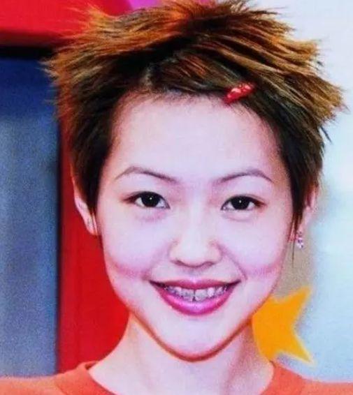 明星整牙前后照片,整牙前后对比，惊艳时光流转